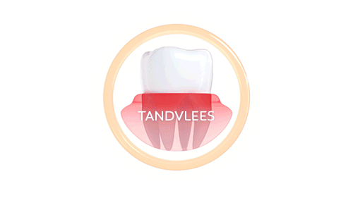 TANDVLEES