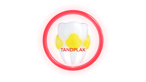 TANDPLAK