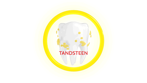 TANDSTEEN