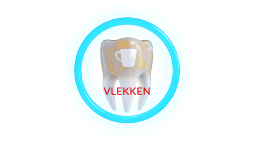 VLEKKEN